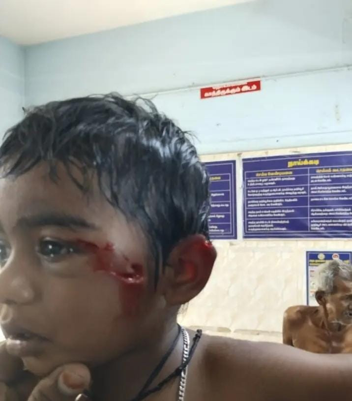 பழனியில் சிறுவனுக்கு நேர்ந்த கொடூரம்....! கண்டுகொள்ளாத அதிகாரிகள்....!
