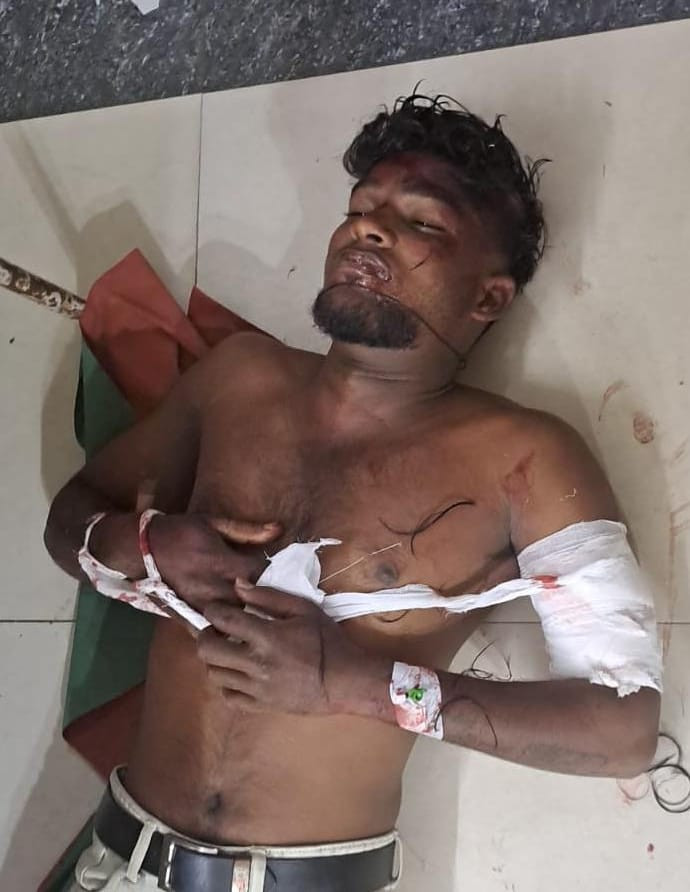 திண்டுக்கல் பரபரப்பு...! வாலிபர் பலி....! போலீசார் தீவிர விசாரணை....!