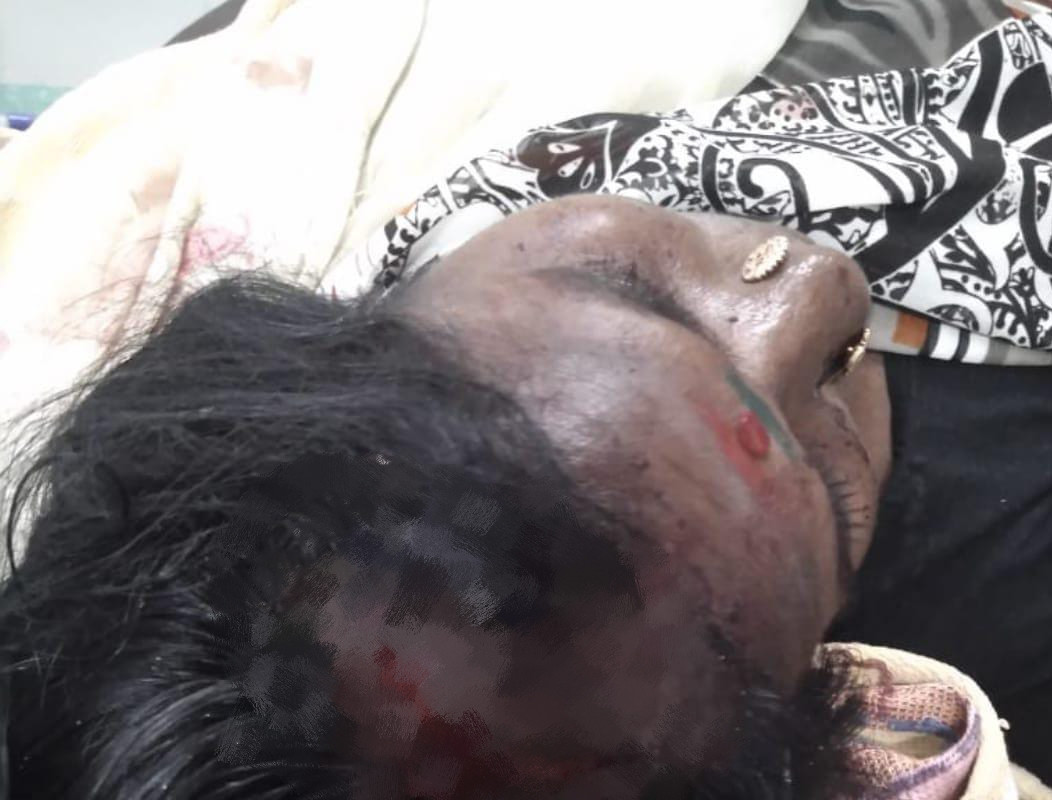 மனைவிக்கு அரிவாள் வெட்டு...! போலீசார் தீவிர விசாரணை....!